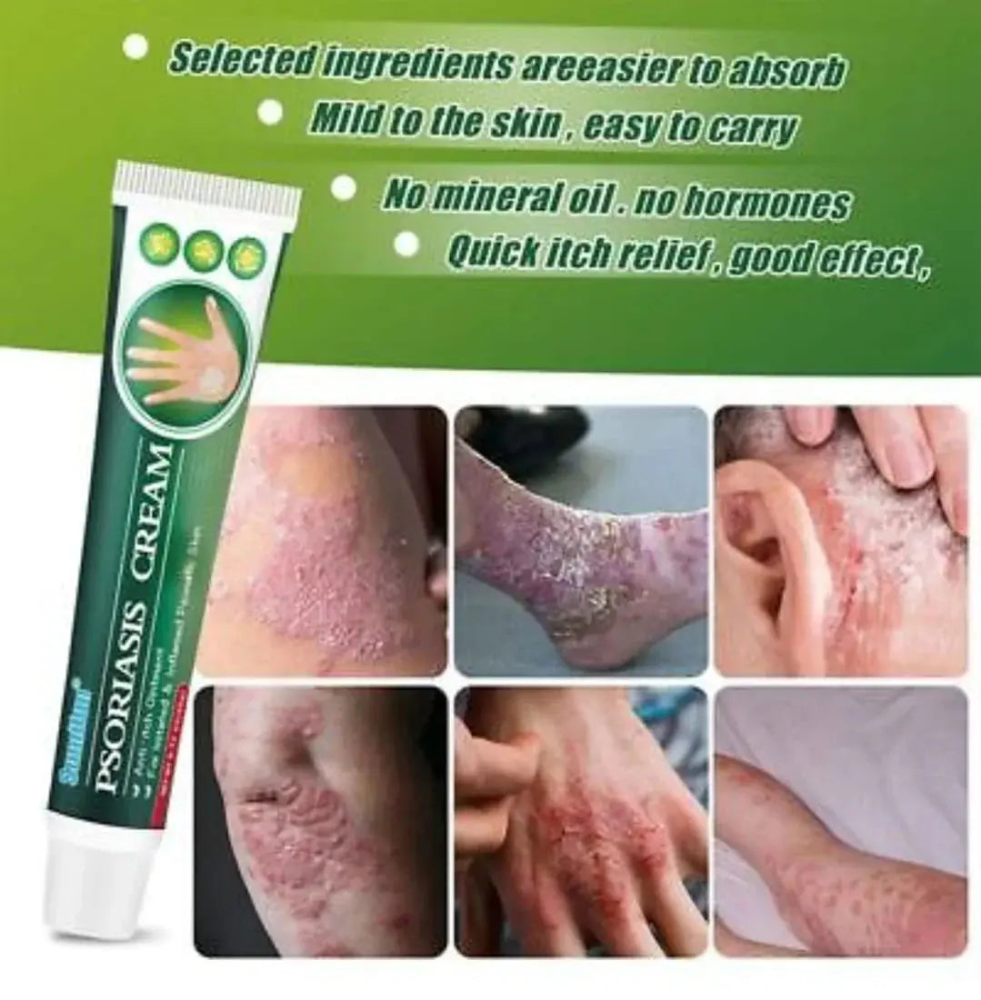 Psoriasis Cream (Original) – 20g Petra Bazaar